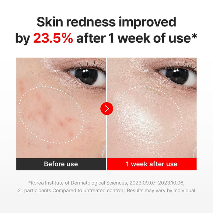 CENTELLIAN 24 MADECA CREAM TIME REVERSE (SEASON7, 50ml/1.69fl oz) | Intensive Skin Repair & Firming
