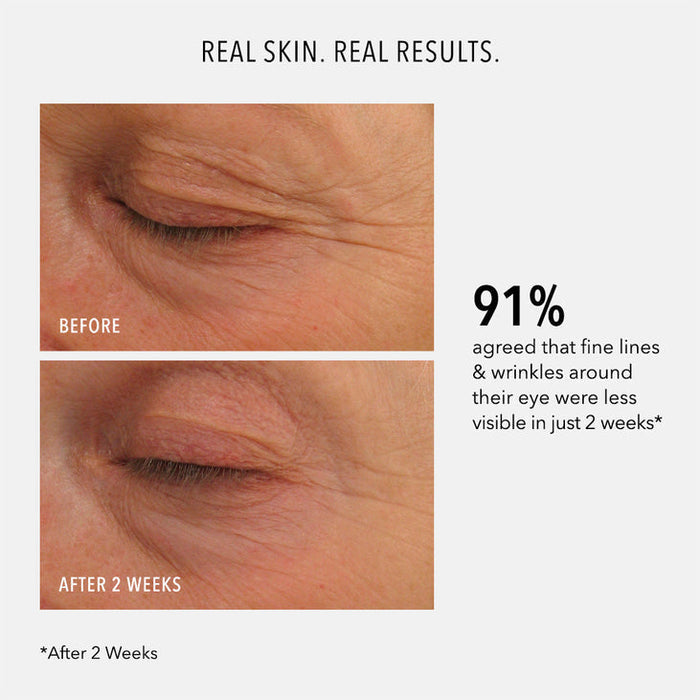 EYE AUTHORITY - Dark Circles, Puffiness, Fine Lines