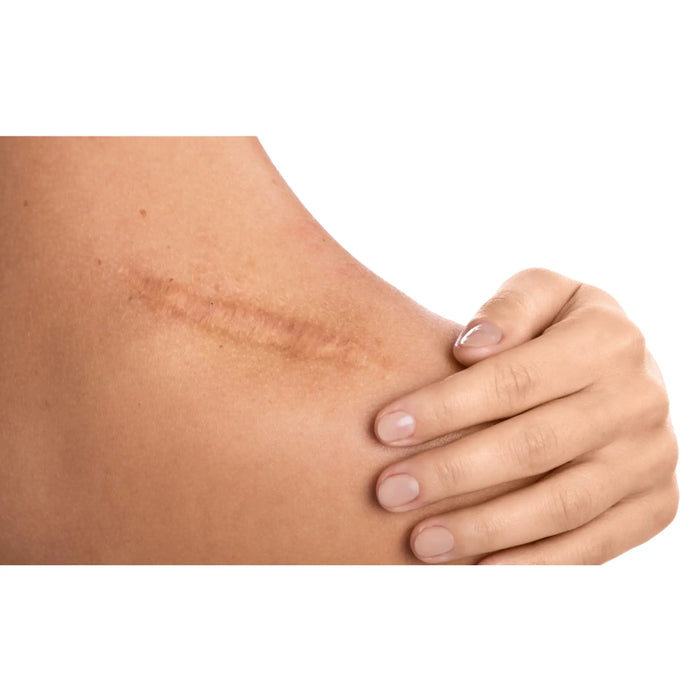 Care oil - Cica7 - Scar Areas - Roll-On - Eona Eona
