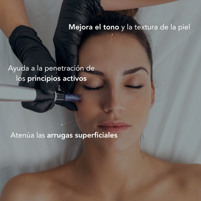 Tarjeta Regalo Facial Dermapen